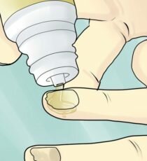 Нанесение препарата от грибка на ногти